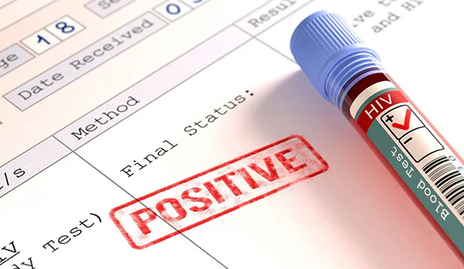Kết quả xét nghiệm dương tính