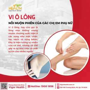 vi ô lông và phương pháp loại bỏ