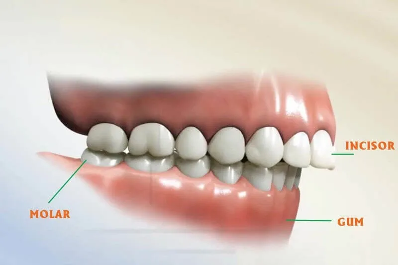 Răng khểnh trong tiếng Anh gọi là Crooked Tooth