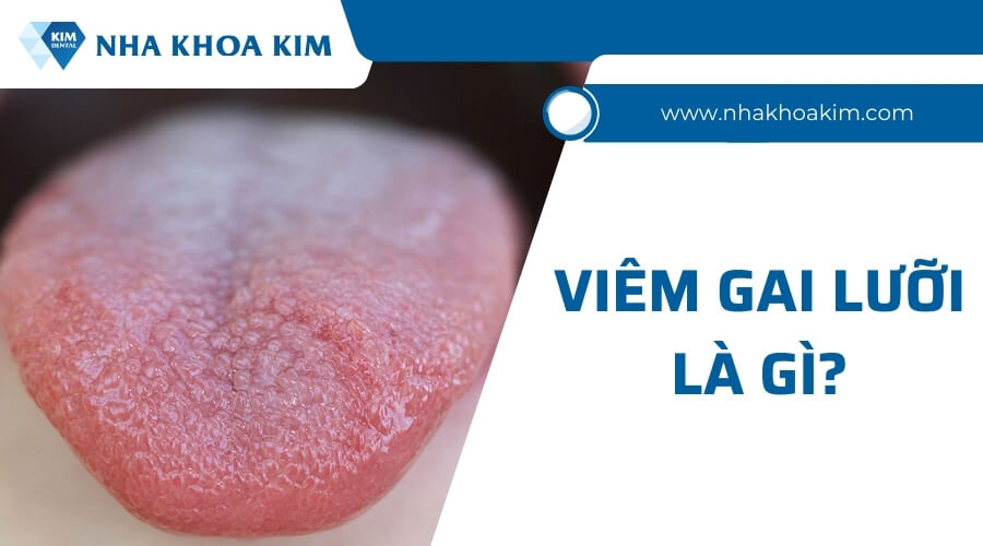 Khám Phá Kỹ Thuật