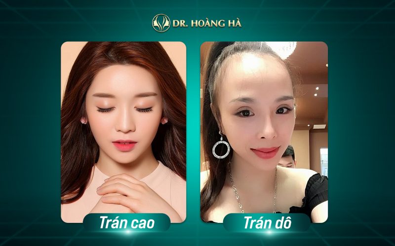 Trần Vợ là gì - Hiểu rõ về khái niệm và ý nghĩa đằng sau