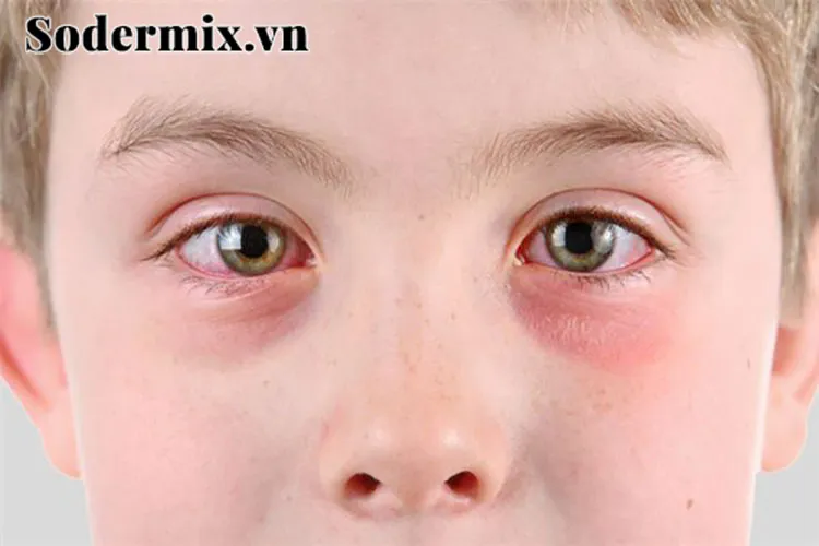 Ngứa mắt trái được coi là một điềm báo may mắn sắp đến với bạn.